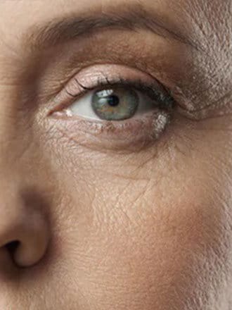 Eye Care