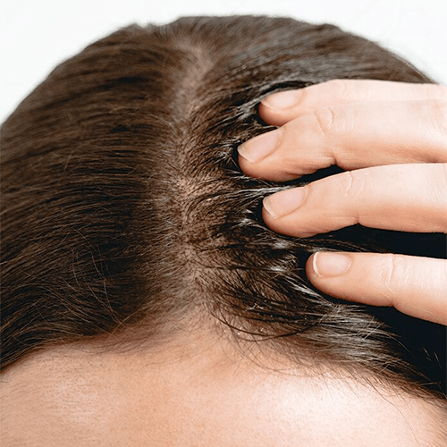 Multi-Peptide Serum for Hair Density