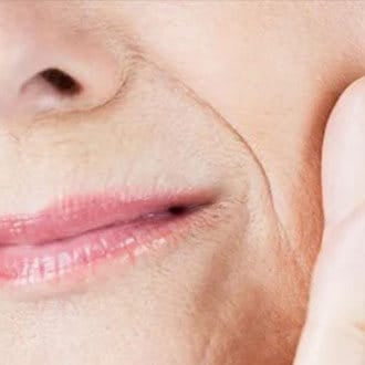 Signs of Aging