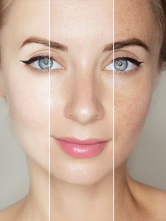 Uneven Skin