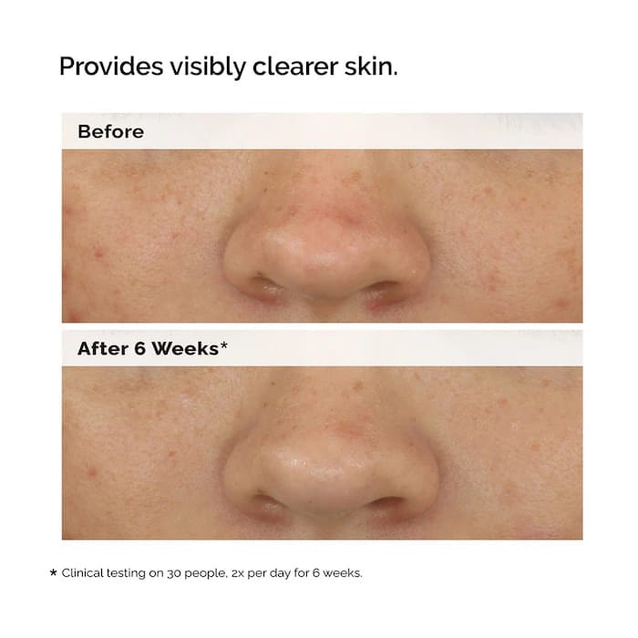 Balancing & Clarifying Serum